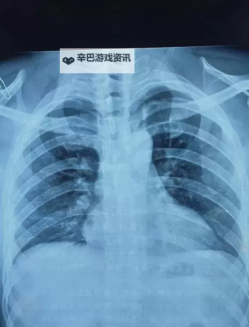 我想看胸片曝光2024今日更新：最新猛料全在这里图1